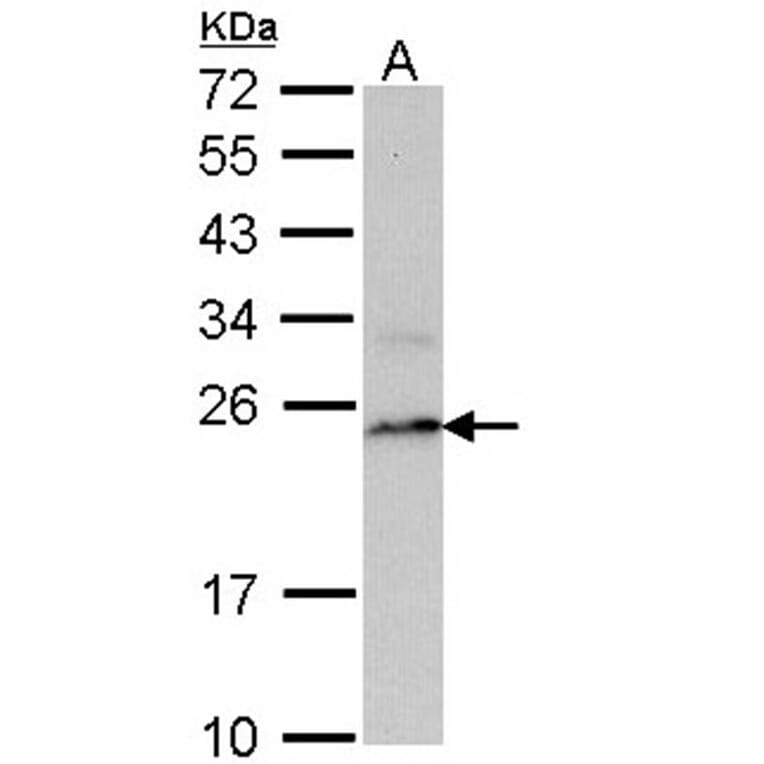 PSMB8 antibody from Signalway Antibody (22848) - Antibodies.com