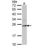 PSMB8 antibody from Signalway Antibody (22848) - Antibodies.com