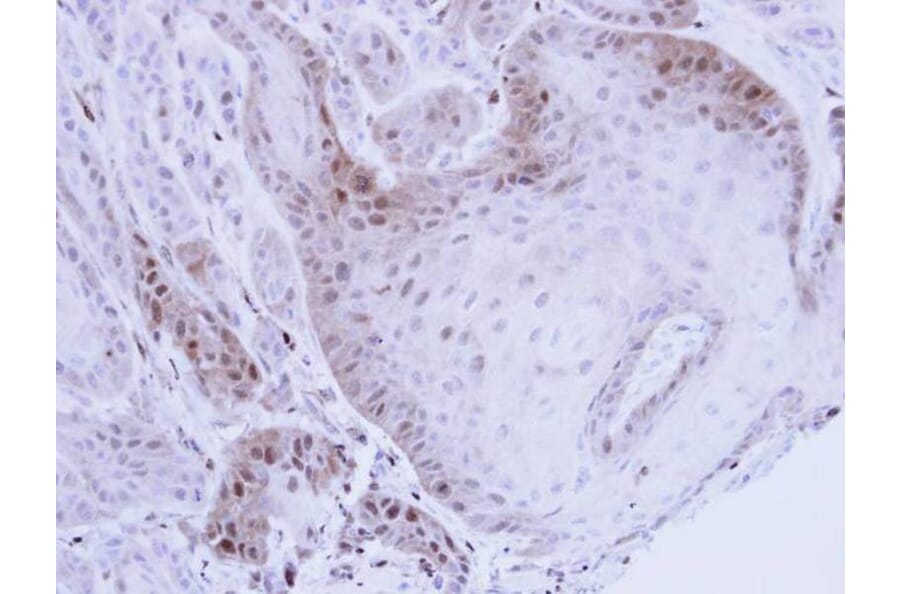 Immunohistochemistry - PSMB8 antibody from Signalway Antibody (22848) - Antibodies.com