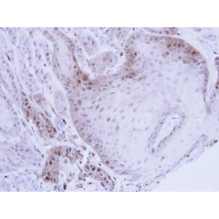 Immunohistochemistry - PSMB8 antibody from Signalway Antibody (22848) - Antibodies.com