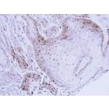 Immunohistochemistry - PSMB8 antibody from Signalway Antibody (22848) - Antibodies.com