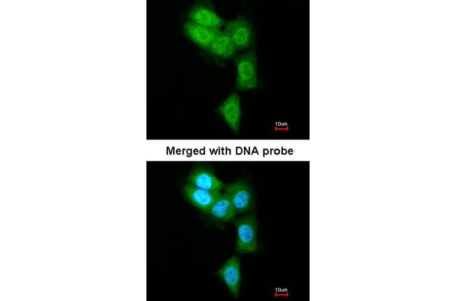 Immunofluorescence - PSMB8 antibody from Signalway Antibody (22848) - Antibodies.com