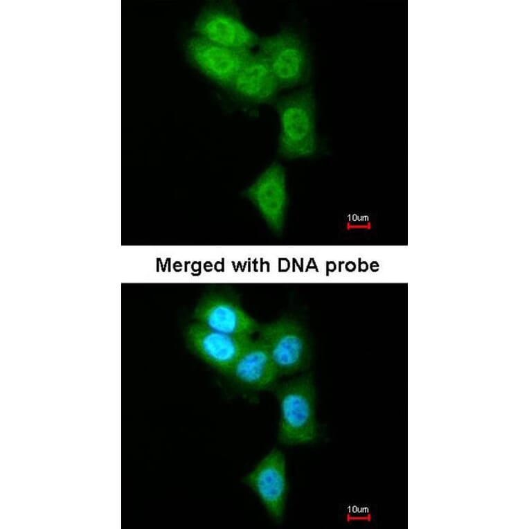 Immunofluorescence - PSMB8 antibody from Signalway Antibody (22848) - Antibodies.com