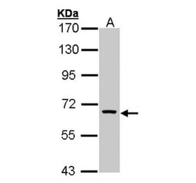FANCC antibody from Signalway Antibody (22857) - Antibodies.com