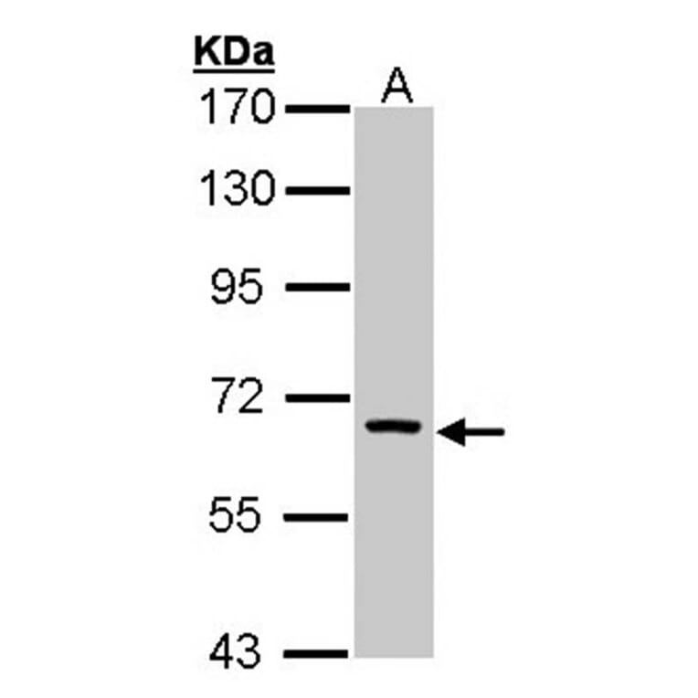 FANCC antibody from Signalway Antibody (22857) - Antibodies.com