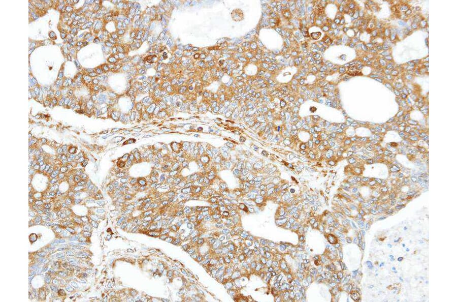 Immunohistochemistry - FANCC antibody from Signalway Antibody (22857) - Antibodies.com