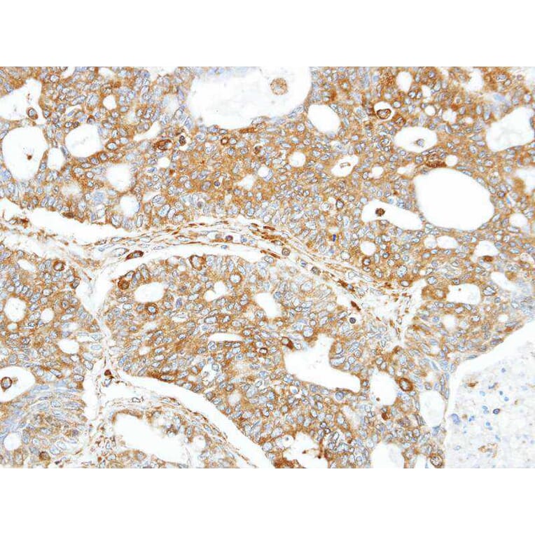 Immunohistochemistry - FANCC antibody from Signalway Antibody (22857) - Antibodies.com