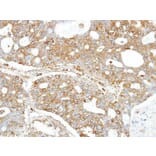 Immunohistochemistry - FANCC antibody from Signalway Antibody (22857) - Antibodies.com