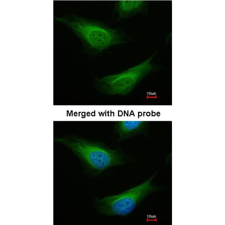 Immunofluorescence - FANCC antibody from Signalway Antibody (22857) - Antibodies.com