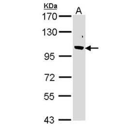Fbp5B antibody from Signalway Antibody (22864) - Antibodies.com