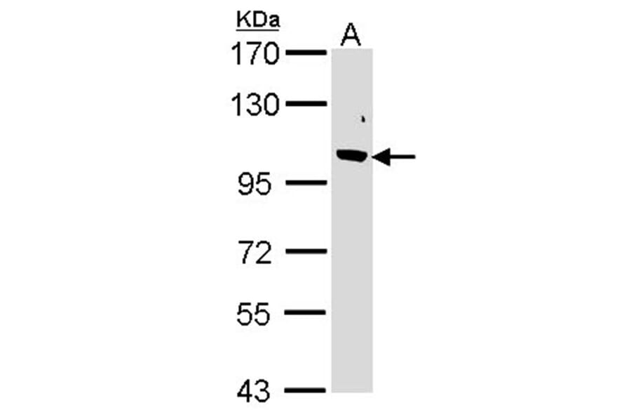Fbp5B antibody from Signalway Antibody (22864) - Antibodies.com