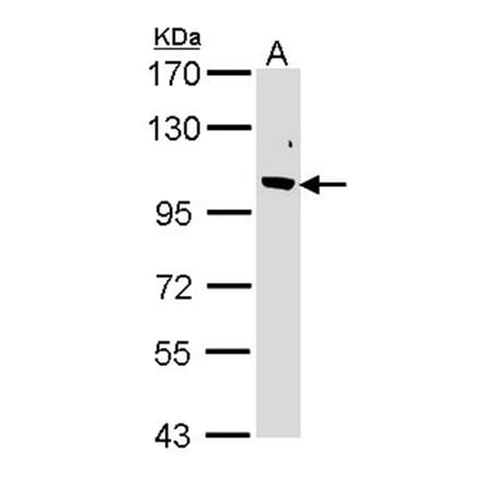 Fbp5B antibody from Signalway Antibody (22864) - Antibodies.com