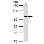 Fbp5B antibody from Signalway Antibody (22864) - Antibodies.com