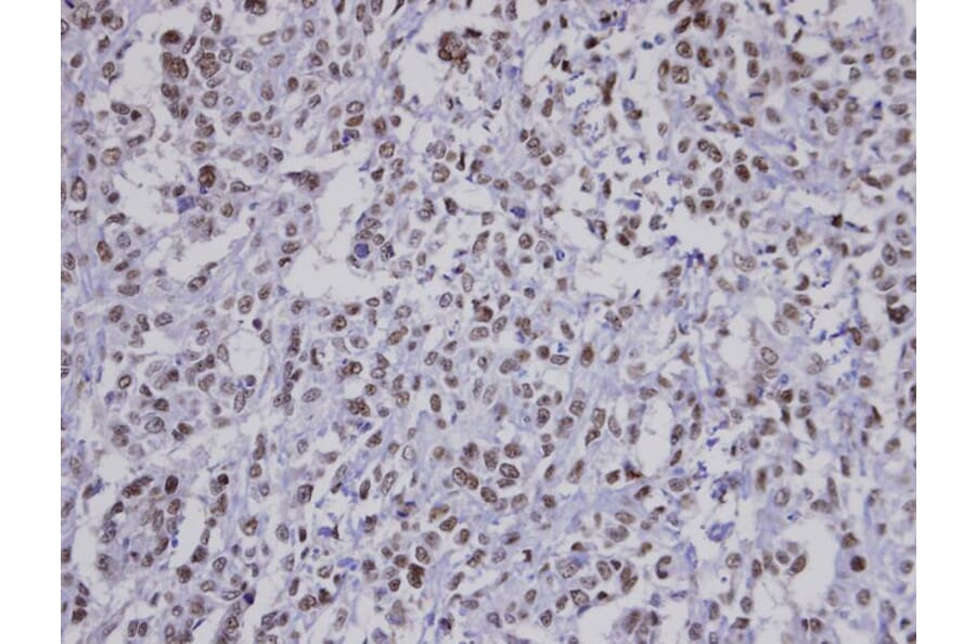 Immunohistochemistry - Fbp5B antibody from Signalway Antibody (22864) - Antibodies.com