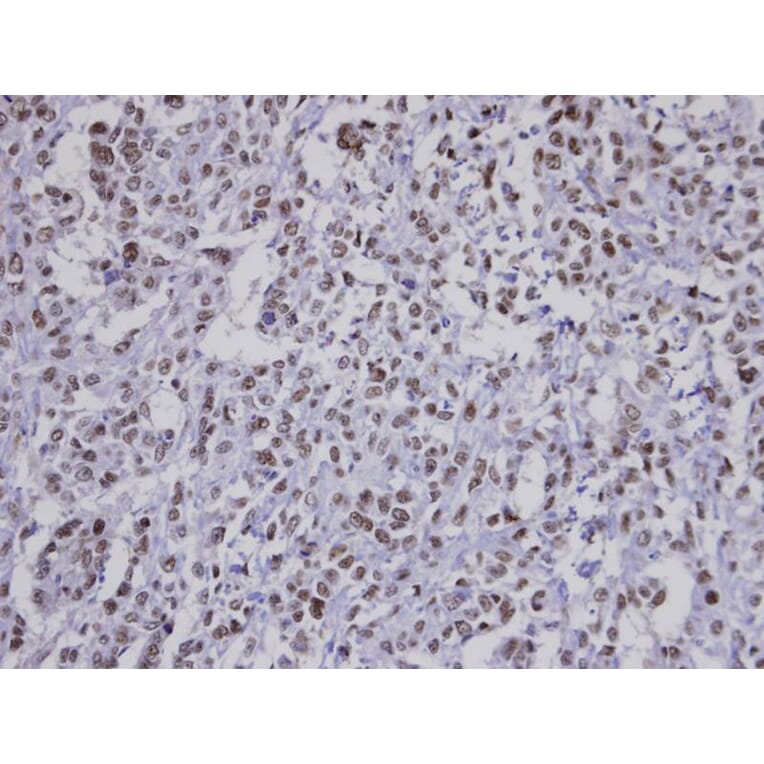 Immunohistochemistry - Fbp5B antibody from Signalway Antibody (22864) - Antibodies.com