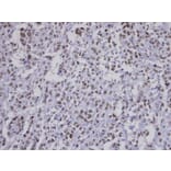 Immunohistochemistry - Fbp5B antibody from Signalway Antibody (22864) - Antibodies.com