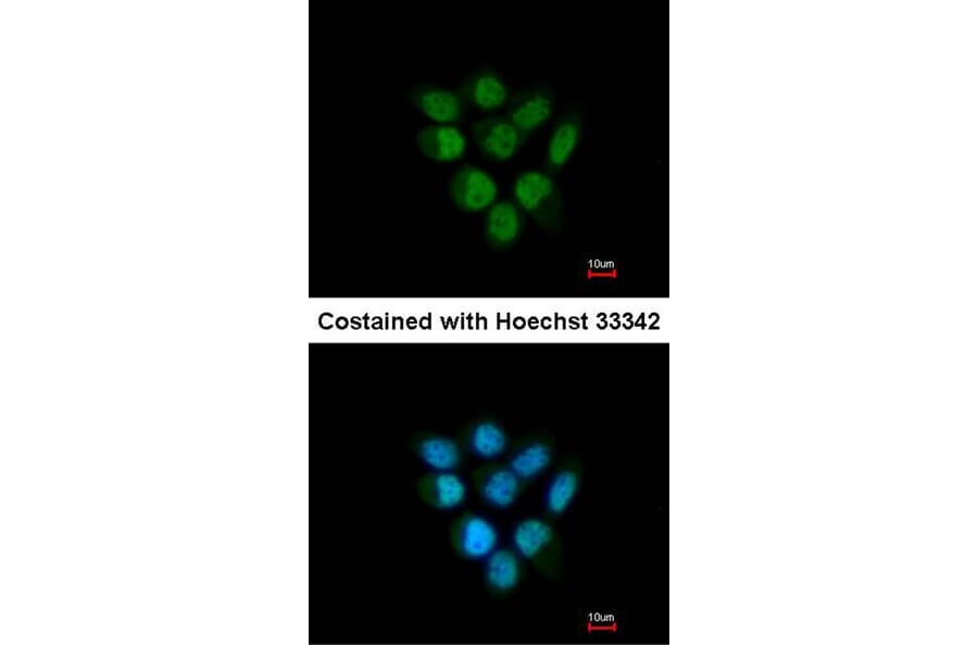 Immunofluorescence - Fbp5B antibody from Signalway Antibody (22864) - Antibodies.com
