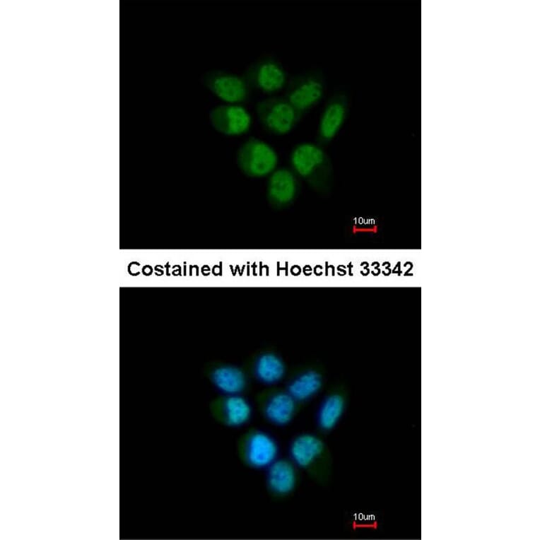 Immunofluorescence - Fbp5B antibody from Signalway Antibody (22864) - Antibodies.com