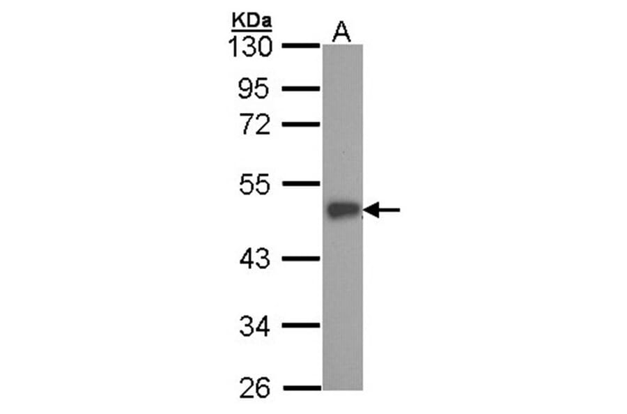 ESE1 antibody from Signalway Antibody (22900) - Antibodies.com
