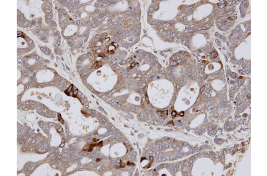 Immunohistochemistry - ESE1 antibody from Signalway Antibody (22900) - Antibodies.com