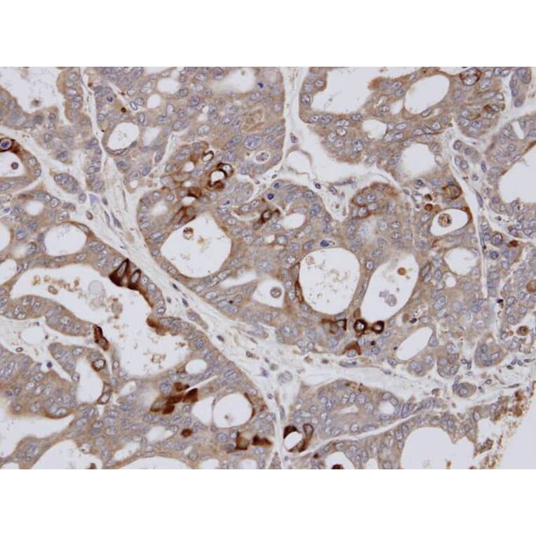 Immunohistochemistry - ESE1 antibody from Signalway Antibody (22900) - Antibodies.com