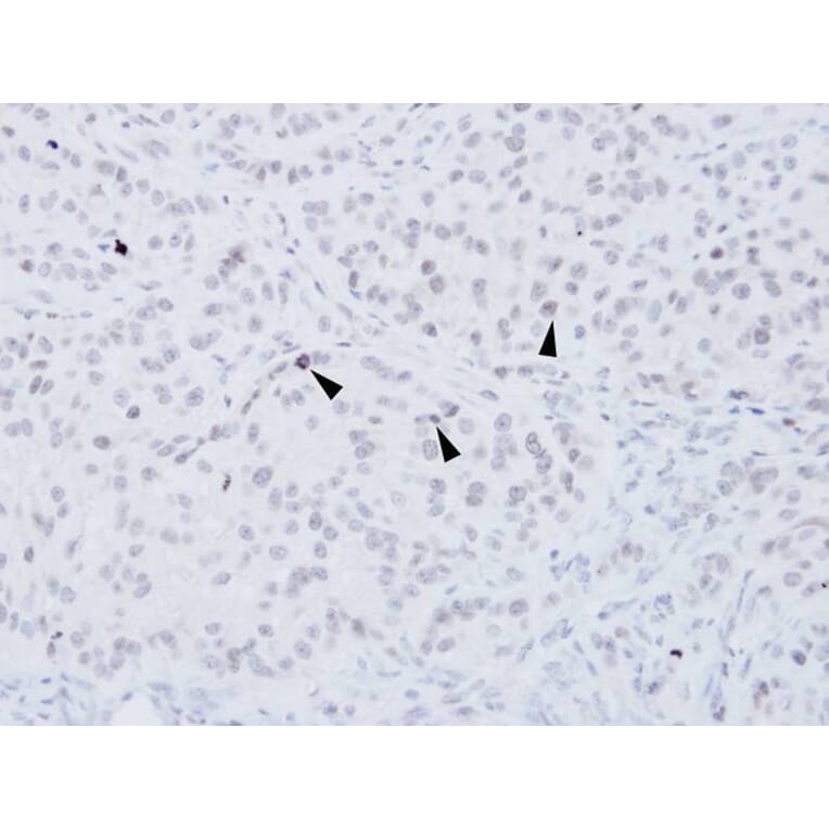 Immunohistochemistry - XRCC4 antibody from Signalway Antibody (22951) - Antibodies.com