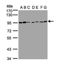 CD66e antibody from Signalway Antibody (22983) - Antibodies.com