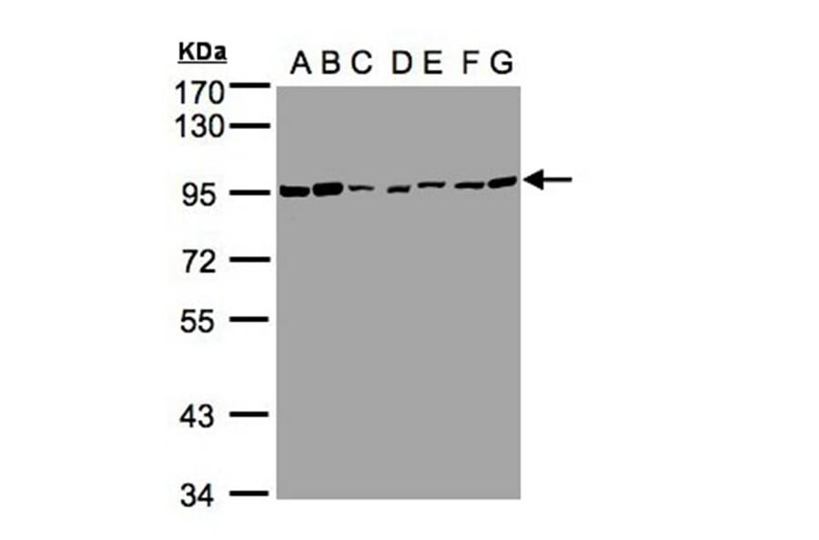 CD66e antibody from Signalway Antibody (22983) - Antibodies.com