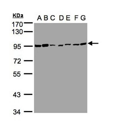 CD66e antibody from Signalway Antibody (22983) - Antibodies.com