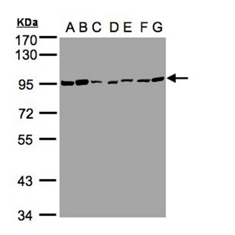 CD66e antibody from Signalway Antibody (22983) - Antibodies.com