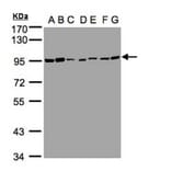 CD66e antibody from Signalway Antibody (22983) - Antibodies.com