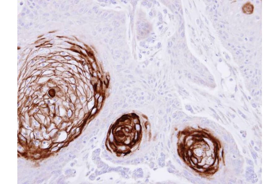 Immunohistochemistry - CD66e antibody from Signalway Antibody (22983) - Antibodies.com
