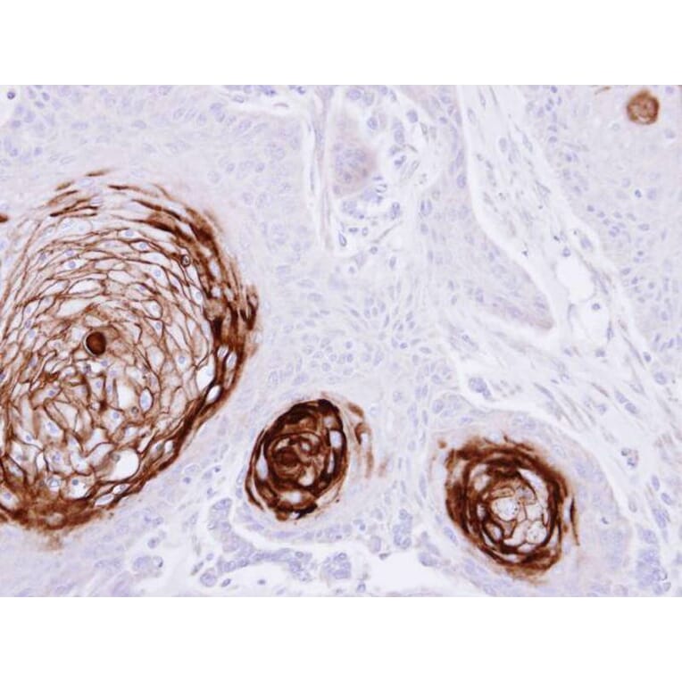 Immunohistochemistry - CD66e antibody from Signalway Antibody (22983) - Antibodies.com