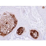 Immunohistochemistry - CD66e antibody from Signalway Antibody (22983) - Antibodies.com