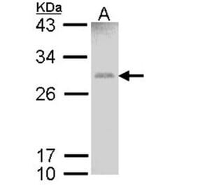 GSTM1 antibody from Signalway Antibody (23009) - Antibodies.com