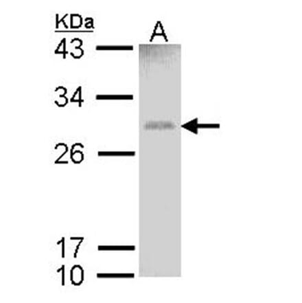GSTM1 antibody from Signalway Antibody (23009) - Antibodies.com