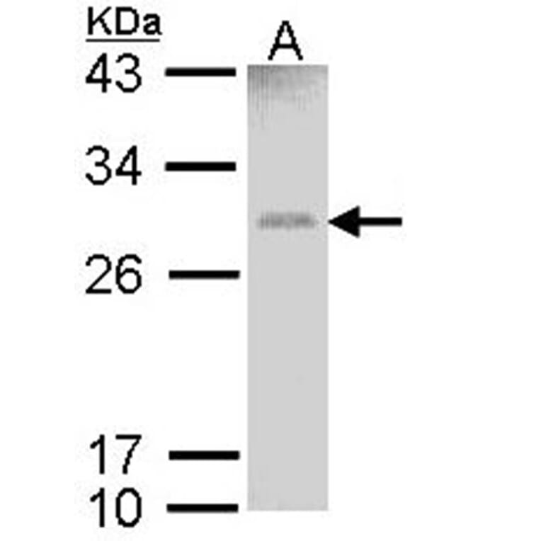 GSTM1 antibody from Signalway Antibody (23009) - Antibodies.com