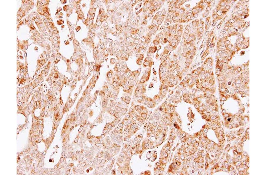 Immunohistochemistry - GSTM1 antibody from Signalway Antibody (23009) - Antibodies.com