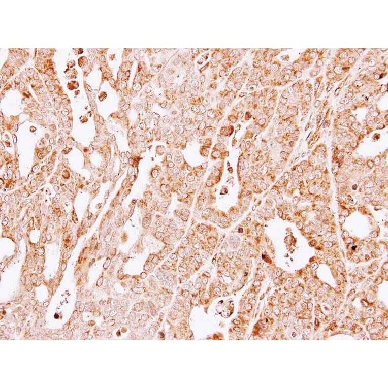 Immunohistochemistry - GSTM1 antibody from Signalway Antibody (23009) - Antibodies.com