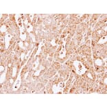 Immunohistochemistry - GSTM1 antibody from Signalway Antibody (23009) - Antibodies.com