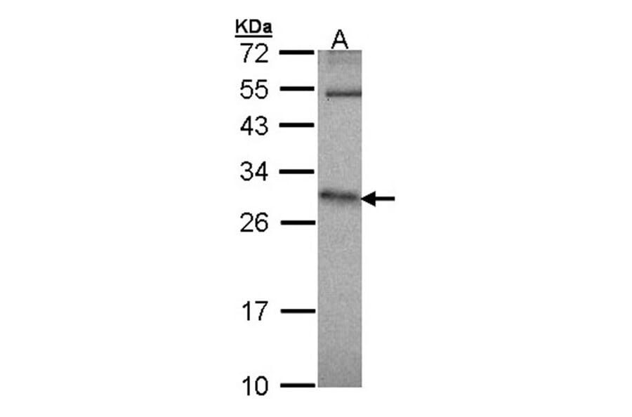 HPRT1 antibody from Signalway Antibody (23018) - Antibodies.com