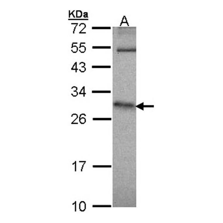 HPRT1 antibody from Signalway Antibody (23018) - Antibodies.com