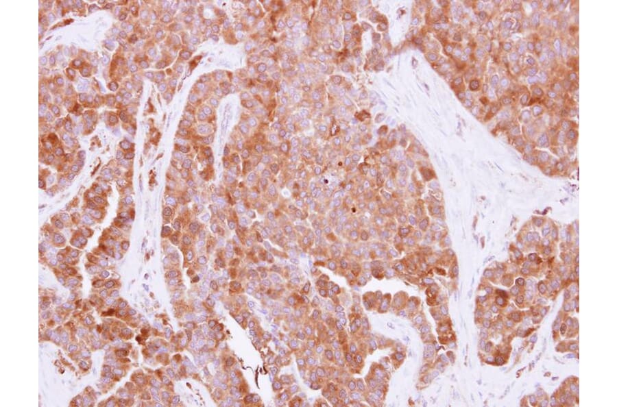 Immunohistochemistry - HPRT1 antibody from Signalway Antibody (23018) - Antibodies.com