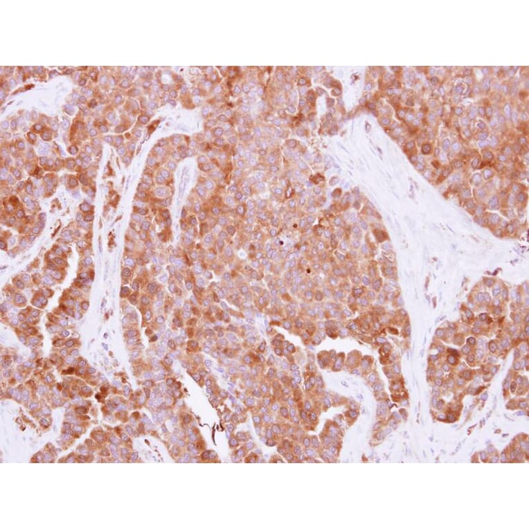 Immunohistochemistry - HPRT1 antibody from Signalway Antibody (23018) - Antibodies.com
