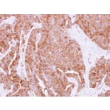 Immunohistochemistry - HPRT1 antibody from Signalway Antibody (23018) - Antibodies.com
