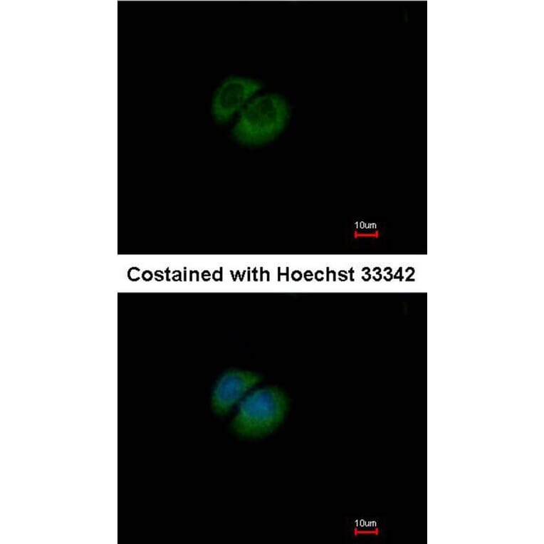 Immunofluorescence - HPRT1 antibody from Signalway Antibody (23018) - Antibodies.com