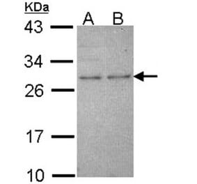 HPRT antibody from Signalway Antibody (23019) - Antibodies.com