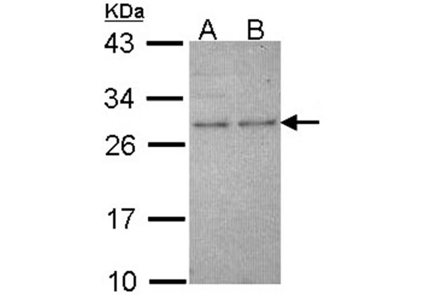 HPRT antibody from Signalway Antibody (23019) - Antibodies.com