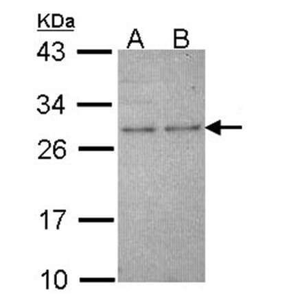 HPRT antibody from Signalway Antibody (23019) - Antibodies.com