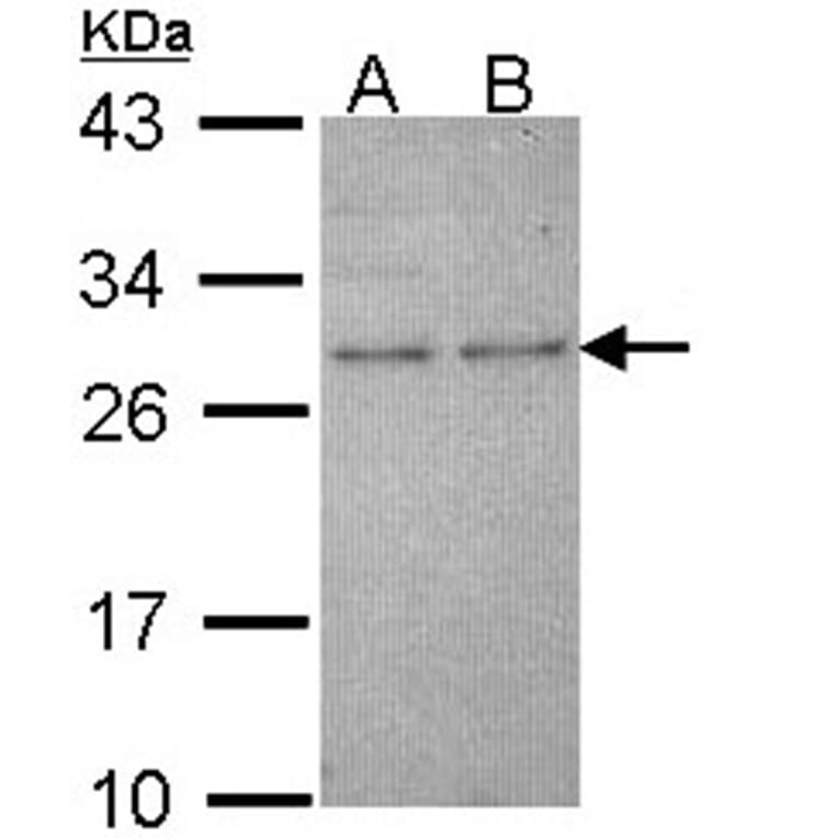 HPRT antibody from Signalway Antibody (23019) - Antibodies.com